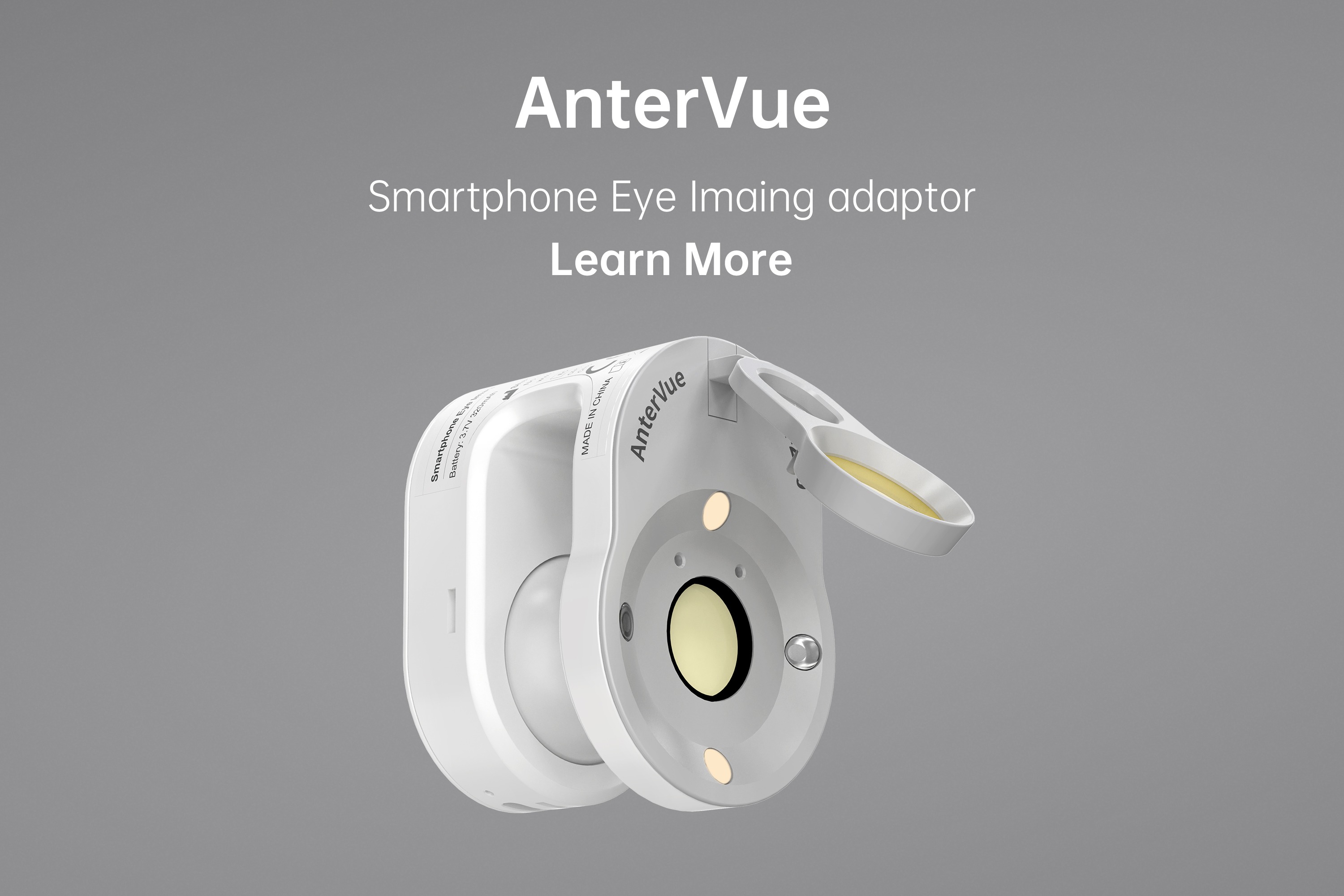 AnterVue